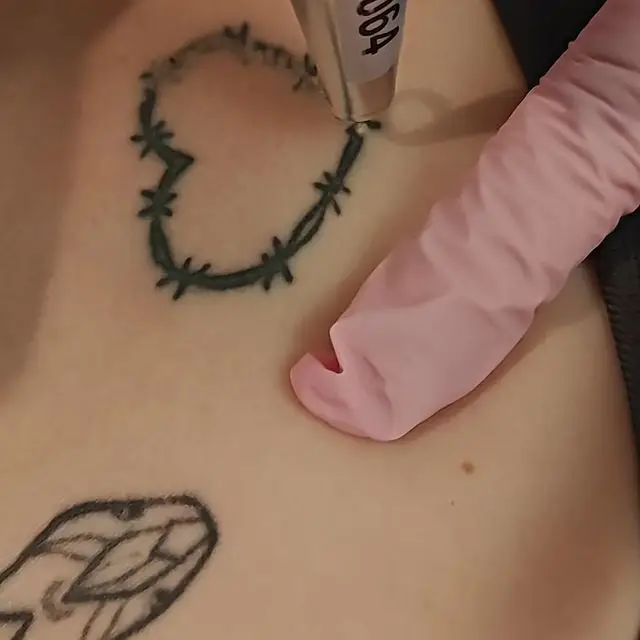 Tattoo verwijdering Laser-Care