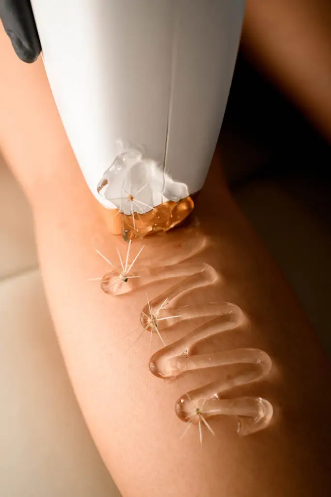 laserontharing behandeling been bij Laser-Care Brugge